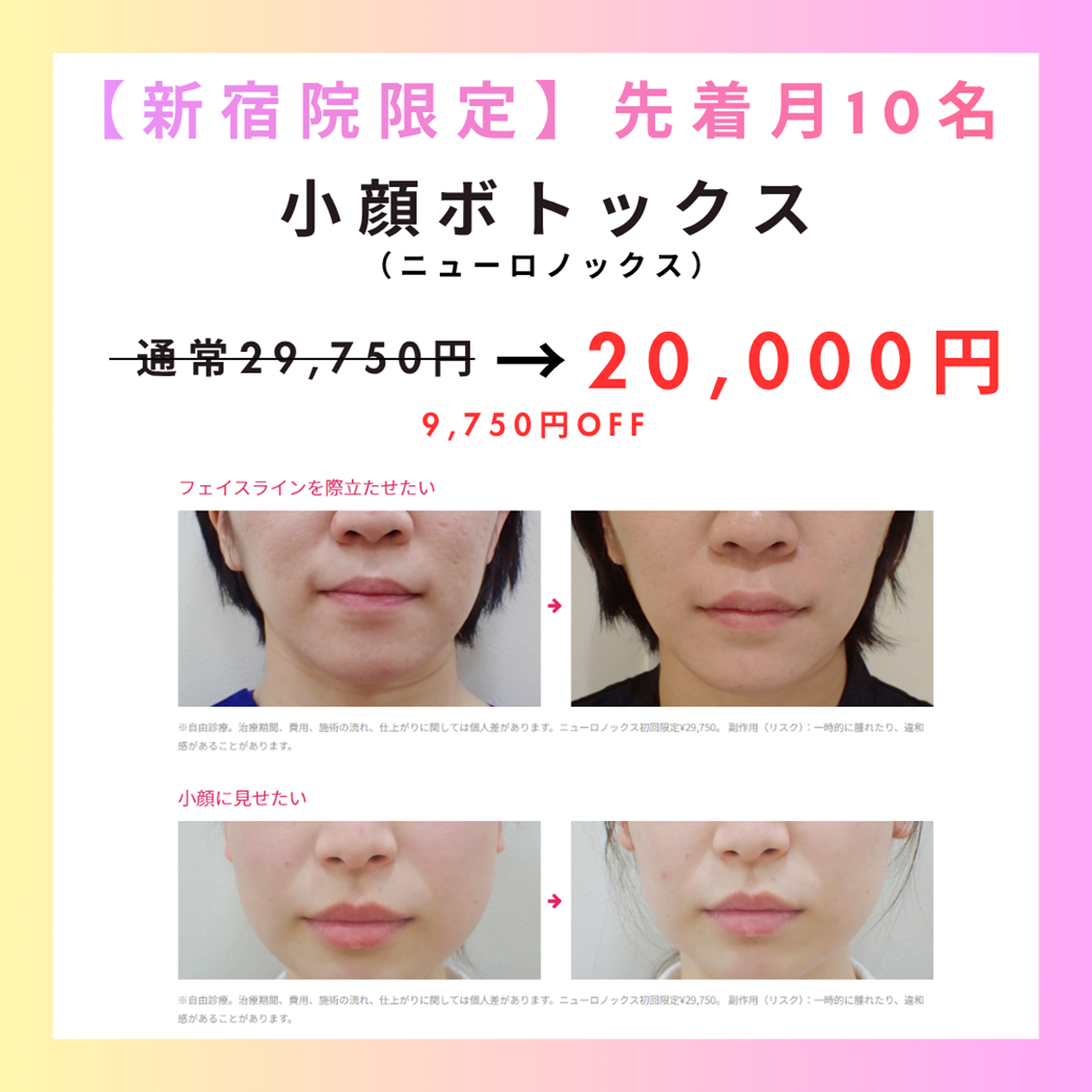 【新宿院限定・先着10名まで】小顔ボトックス