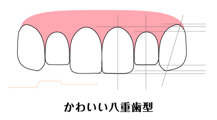 かわいい八重歯型